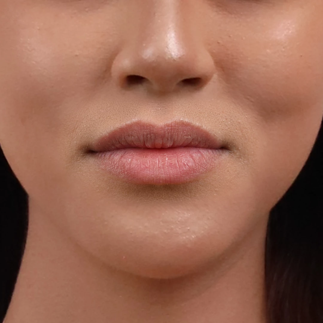 before lip serum before lip serum